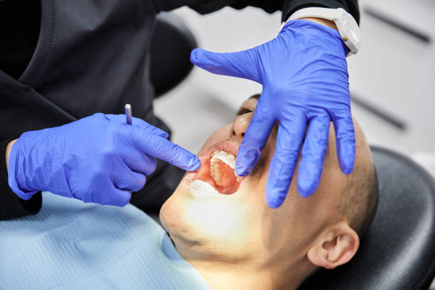 Best Emergency Dentist for Lost Fillings or Crowns in Coldwater, MS